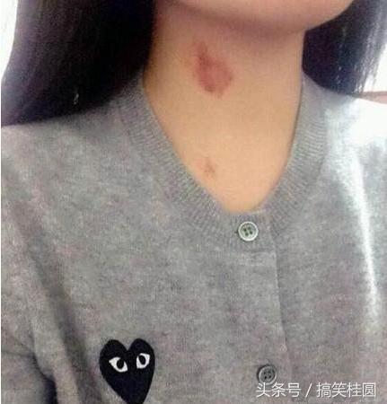 435a00031441fc591f24