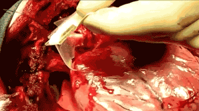 472500034b7a79479f29