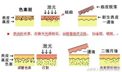 皮肤美容宋丽秋：春季如何拒绝万“斑”宠爱？-5.jpg