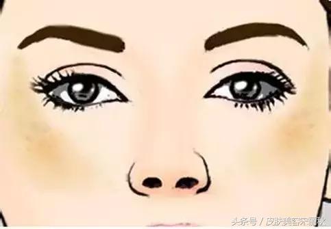 皮肤美容宋丽秋：春季如何拒绝万“斑”宠爱？-8.jpg