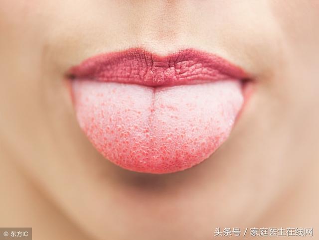 从舌头看身体的健康状况，有这3个表现，就要注意身体了-3.jpg